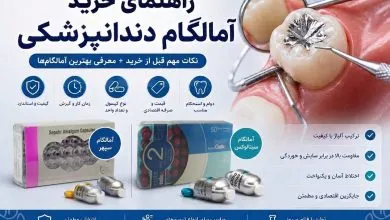 راهنمای خرید آمالگام دندانپزشکی